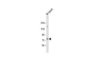 Anti-SLC6A8 Antibody (N-Term) at 1:2000 dilution + mouse heart lysate Lysates/proteins at 20 μg per lane. (SLC6A8 Antikörper  (AA 180-212))