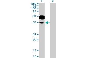 Western Blot analysis of RHOXF2 expression in transfected 293T cell line by RHOXF2 MaxPab polyclonal antibody. (RHOXF2 Antikörper  (AA 1-288))