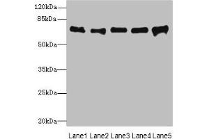 Western blot All lanes: SPDL1 antibody at 4 μg/mL Lane 1: Hela whole cell lysate Lane 2: 293T whole cell lysate Lane 3: Jurkat whole cell lysate Lane 4: A549 whole cell lysate Lane 5: K562 whole cell lysate Secondary Goat polyclonal to rabbit IgG at 1/10000 dilution Predicted band size: 71, 59, 62 kDa Observed band size: 71 kDa (CCDC99 Antikörper  (AA 1-300))