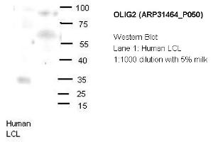 Image no. 2 for anti-Oligodendrocyte Lineage Transcription Factor 2 (OLIG2) (N-Term) antibody (ABIN2777314) (OLIG2 Antikörper  (N-Term))