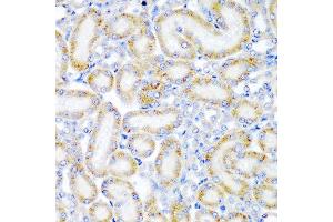 Immunohistochemistry of paraffin-embedded rat kidney using WRB antibody at dilution of 1:200 (40x lens). (WRB Antikörper)