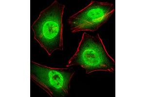 Fluorescent image of Hela cells stained with GTF2I Antibody (C-term) (ABIN390868 and ABIN2841085).