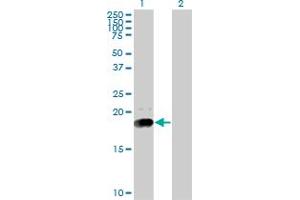 Western Blot analysis of NPC2 expression in transfected 293T cell line by NPC2 monoclonal antibody (M01), clone 4B9.