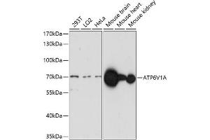 Western blot analysis of extracts of various cell lines, using V1A antibody (ABIN7265765) at 1:1000 dilution. (ATP6V1A Antikörper  (AA 500-600))