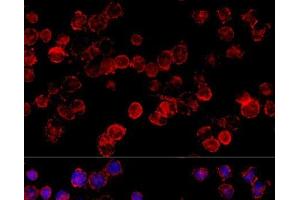 Immunofluorescence analysis of HeLa cells using CYP3A7 Polyclonal Antibody at dilution of 1:100 (40x lens).