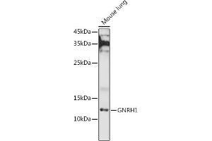 Western blot analysis of extracts of Mouse lung, using GNRH1 antibody (ABIN6131875, ABIN6141257, ABIN6141258 and ABIN6221260) at 1:1000 dilution.