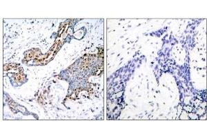 Image no. 1 for anti-Estrogen Receptor 1 (ESR1) (pSer118) antibody (ABIN196742) (Estrogen Receptor alpha Antikörper  (pSer118))