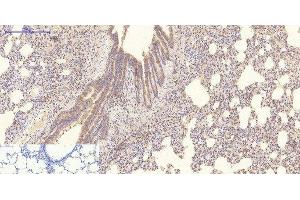 Immunohistochemistry of paraffin-embedded Rat lung tissue using COL4A1 Monoclonal Antibody at dilution of 1:200. (COL4A1 Antikörper)