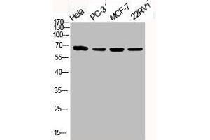 Western Blot analysis of HELA PC3 MCF7 22RV1 cells using Phospho-PKC ζ (T410) Polyclonal Antibody (PKC zeta Antikörper  (pThr410))