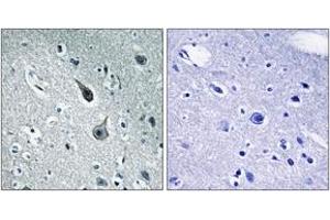 Immunohistochemistry analysis of paraffin-embedded human brain tissue, using 5-HT-2A Antibody. (HTR2A Antikörper  (AA 422-471))