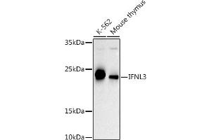Western blot analysis of extracts of various cell lines, using IFNL3 antibody (ABIN6132858, ABIN6142207, ABIN6142209 and ABIN6221289) at 1:500 dilution.