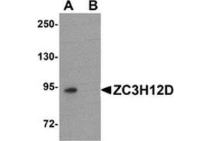 Western blot analysis of ZC3H12D in THP-1 cell lysate with ZC3H12D antibody at 1 μg/ml in (A) the absence and (B) the presence of blocking peptide.