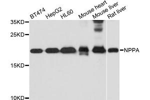 Western blot analysis of extracts of various cell lines, using NPPA antibody. (NPPA Antikörper)