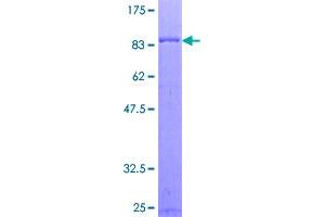 Regulator of G-Protein Signaling 7 (RGS7) (AA 1-487) protein (GST tag)