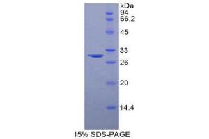 SDS-PAGE (SDS) image for Sphingosine Kinase 1 (SPHK1) (AA 148-398) protein (His tag) (ABIN2122126) (SPHK1 Protein (AA 148-398) (His tag))