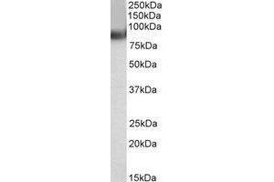 AP22452PU-N TRIM55 antibody staining of Human Heart lysate at 0. (TRIM55 Antikörper  (C-Term))