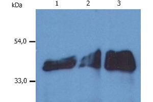 Western Blotting analysis (reducing conditions) of whole cell lysate using anti-human Cytokeratin 18 (DA-7). (Cytokeratin 18 Antikörper)
