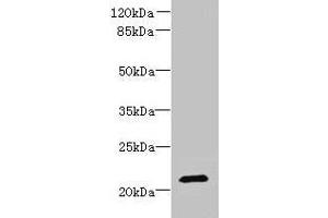 Western blot All lanes: DYDC1 antibody at 4 μg/mL + Hela whole cell lysate Secondary Goat polyclonal to rabbit IgG at 1/10000 dilution Predicted band size: 21, 22 kDa Observed band size: 21 kDa (DYDC1 Antikörper  (AA 1-177))
