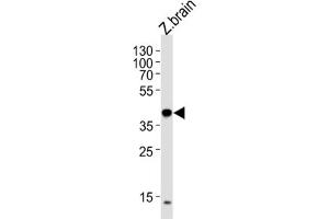 Western Blotting (WB) image for anti-Eukaryotic Translation Initiation Factor 3 Subunit E (EIF3E) antibody (ABIN3000922) (EIF3E Antikörper)
