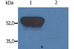 Western Blotting analysis (reducing conditions) of GFAP in porcine brain lysate. (GFAP Antikörper)