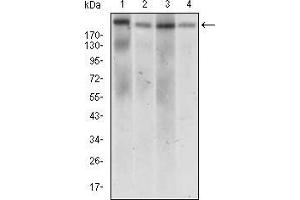 Western blot analysis using IL2RA mouse mAb against Jurkat (1), Cos7 (2), HCT116 (3) and NTERA-2 (4) cell lysate. (DNMT1 Antikörper  (AA 1448-1594))