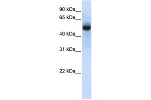 CXORF34 antibody used at 1 ug/ml to detect target protein. (TRMT2B Antikörper  (N-Term))