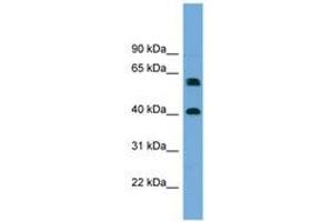 Image no. 1 for anti-Telomeric Repeat Binding Factor 2, Interacting Protein (TERF2IP) (AA 215-264) antibody (ABIN6744163) (RAP1 Antikörper  (AA 215-264))