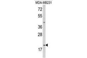 Western blot analysis of IL12A Antibody (C-term) in MDA-MB231 cell line lysates (35ug/lane).
