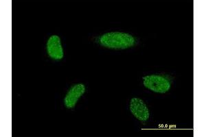 Immunofluorescence of monoclonal antibody to ATOH1 on HeLa cell. (ATOH1 Antikörper  (AA 266-354))