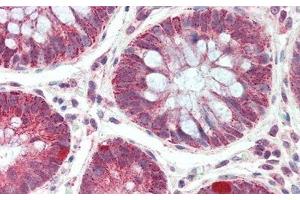 Immunohistochemistry (IHC) image for anti-Protein tyrosine Phosphatase, Receptor Type, J (PTPRJ) (AA 567-842) antibody (ABIN7441778)