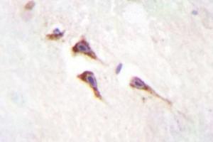 Image no. 2 for anti-Mechanistic Target of Rapamycin (serine/threonine Kinase) (mTOR) antibody (ABIN272127) (MTOR Antikörper)