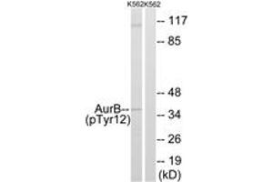 Western blot analysis of extracts from K562 cells, using AurB (Phospho-Tyr12) Antibody. (Aurora Kinase B Antikörper  (pTyr12))