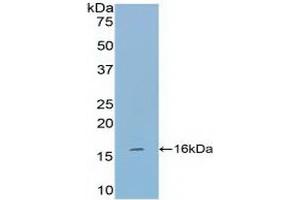 Detection of Recombinant TPS, Mouse using Polyclonal Antibody to Tryptase (TPS) (TPSAB1 Antikörper  (AA 149-273))