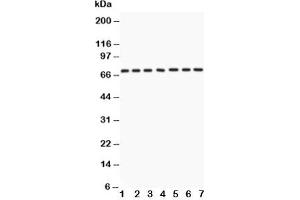Western blot testing of Lamin A antibody and Lane 1:  human placenta;  2: SKOV;  3: SW620;  4: COLO320;  5: HeLa;  6: 293T;  7: A549 lysate (Lamin A/C Antikörper  (AA 481-646))