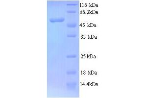 SDS-PAGE (SDS) image for N-Myc Proto-Oncogene Protein (MYCN) (AA 1-464), (full length) protein (His tag) (ABIN4975795) (MYCN Protein (AA 1-464, full length) (His tag))