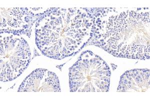 Immunohistochemistry (IHC) image for anti-Fucosidase, alpha-L- 1, Tissue (FUCA1) (AA 185-447) antibody (ABIN7439933)