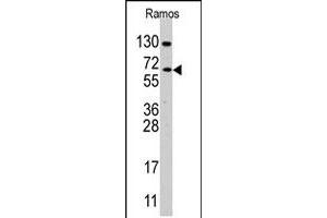 Western blot analysis of CDC25B polyclonal antibody  in Ramos cell line lysates (35 ug/lane). (CDC25B Antikörper  (Internal Region))