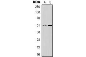 Western blot analysis of GABRD expression in HT29 (A), PC12 (B) whole cell lysates. (GABRD Antikörper)