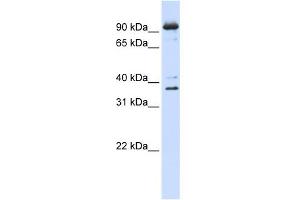 WB Suggested Anti-NCBP1 Antibody Titration:  0. (NCBP1 Antikörper  (N-Term))