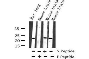 Western blot analysis of Phospho-RhoA (Ser188) expression in various lysates (RHOA Antikörper  (pSer188))