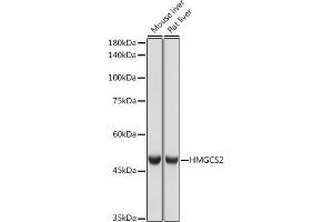 Western blot analysis of extracts of various cell lines, using HMGCS2 antibody (ABIN7265328) at 1:1000 dilution. (HMGCS2 Antikörper)