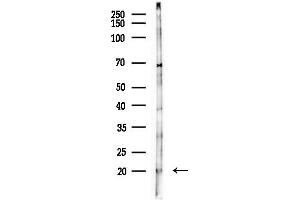 anti-Nuclear Cap Binding Protein Subunit 2 (NCBP2) (N-Term) antibody