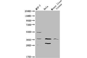Western blot All lanes: MRGPRX2 antibody at 5 μg/mL Lane 1: 293T whole cell lysate Lane 2: Mouse liver tissue Secondary Goat polyclonal to rabbit IgG at 1/10000 dilution Predicted band size: 38 kDa Observed band size: 38 kDa (MRGPRX2 Antikörper  (AA 286-330))