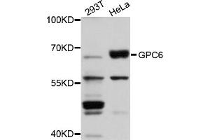 Western blot analysis of extracts of various cell lines, using GPC6 antibody (ABIN5974717) at 1/1000 dilution. (Glypican 6 Antikörper)