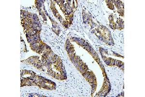 IHC analysis of TAZ using anti-TAZ antibody (ABIN7602384). (TAZ Antikörper  (AA 73-292))