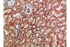 Immunohistochemical analysis of paraffin-embedded human-kidney, antibody was diluted at 1:200 (c-Rel Antikörper  (AA 491-540))