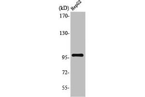 Western Blot analysis of HuvEc cells using Topo IIIβ-1 Polyclonal Antibody (TOP3B Antikörper  (N-Term))