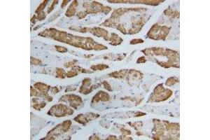 Image no. 1 for anti-Fatty Acid Binding Protein 3, Muscle and Heart (FABP3) (AA 119-133) antibody (ABIN1493379)