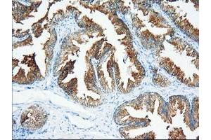 Immunohistochemical staining of paraffin-embedded Human prostate tissue using anti-XPNPEP1 mouse monoclonal antibody. (XPNPEP1 Antikörper)