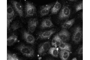 Immunofluorescence staining of A549 (Human lung carcinoma, ATCC CCL-185) cells. (Calnexin Antikörper  (AA 116-301))